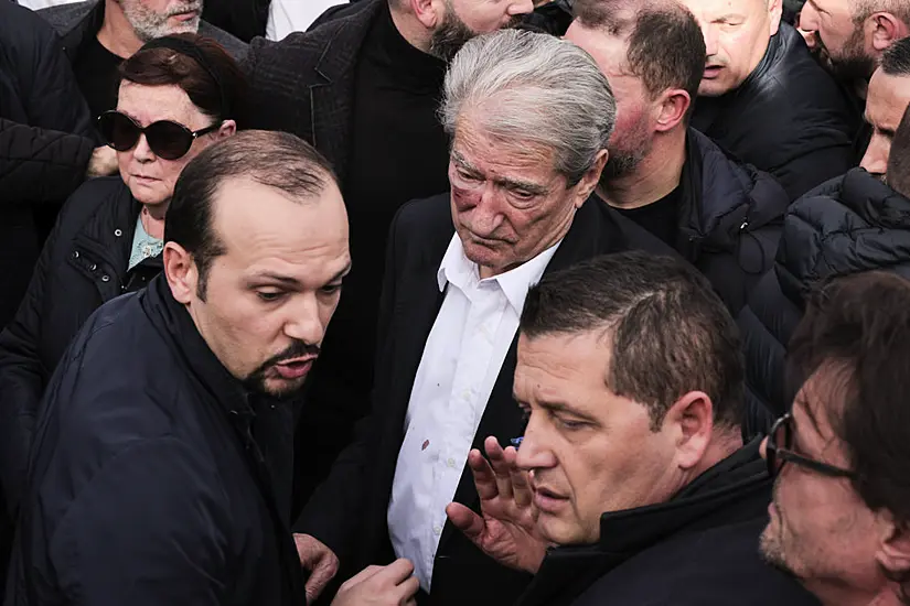 Albanian Opposition Leader Attacked During Anti-Government Protest