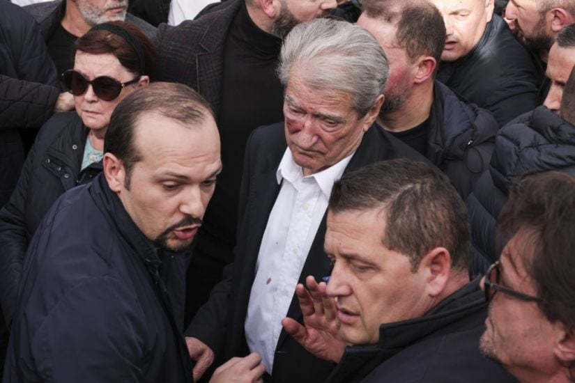 Albanian Opposition Leader Attacked During Anti-Government Protest