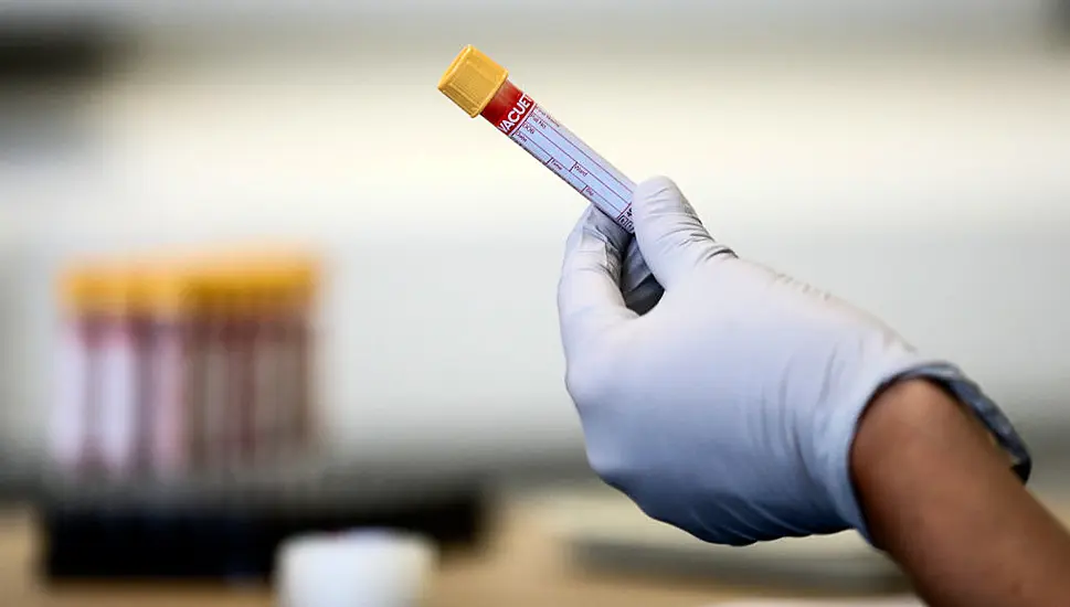 Man Cured Of Hiv After Stem Cell Transplant, Researchers Say