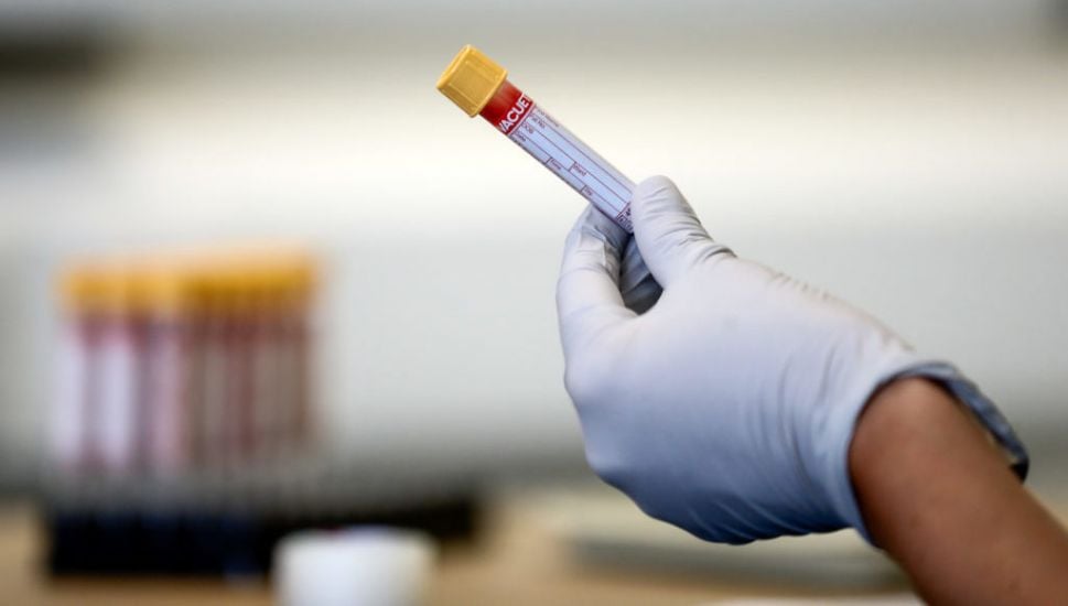 Man Cured Of Hiv After Stem Cell Transplant, Researchers Say