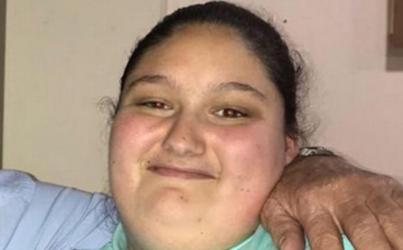 Parents Jailed For Killing Morbidly Obese Teenage Daughter