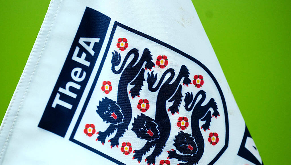 FA and PFA study finds increased dementia risk in ex-footballers