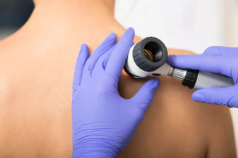 Skin Cancer Cases Reach Record High – How To Spot The Signs