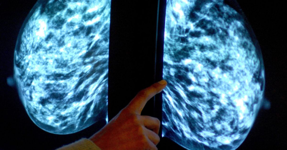 Семейството на 44 годишна жена починала от рак на гърдата уреди