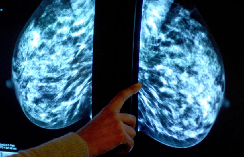 'Ai May Be Able To Safely Assess Breast Cancer Scans', Study Finds