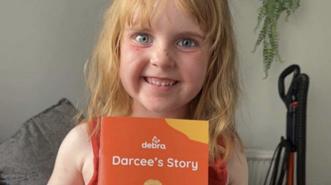 Young Girl Is Cover Star Of Book Explaining Her Skin Condition To Classmates