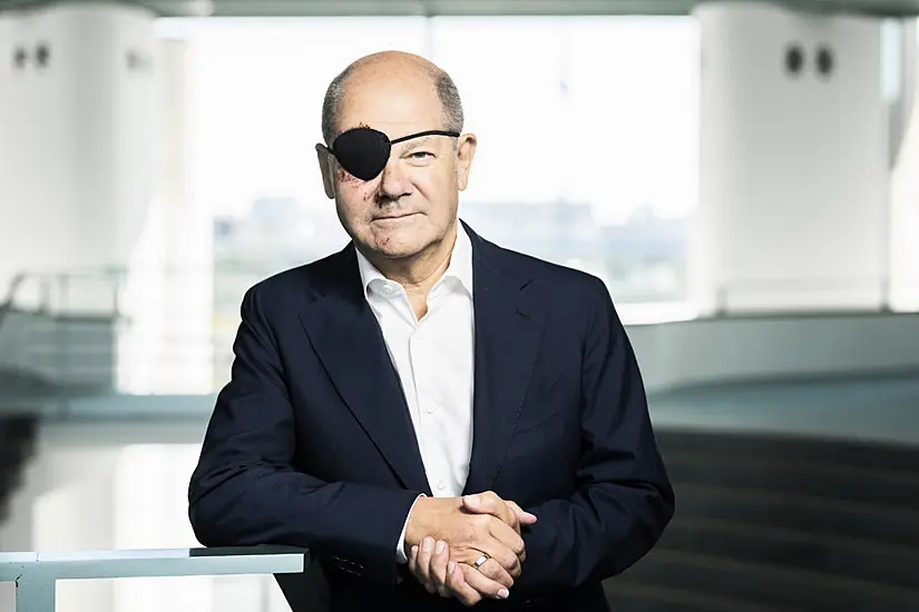 German Leader Tweets Picture Of Himself With Eye Patch After Jogging Accident