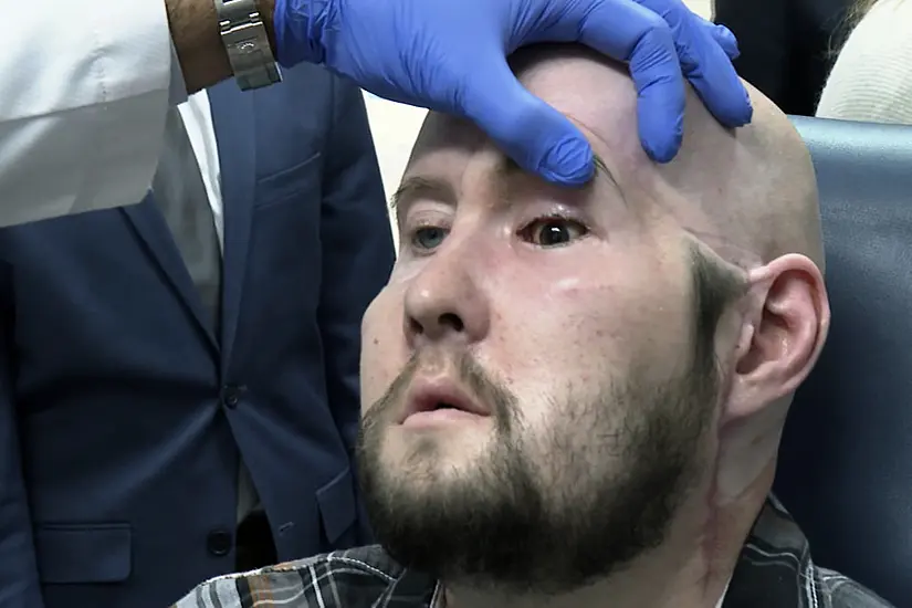 Surgeons Perform World’s First Eye Transplant On Man Who Suffered Electric Shock