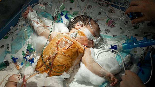 Irish Charity Helps Save Life Of Baby Girl Born On Frontline In Ukraine