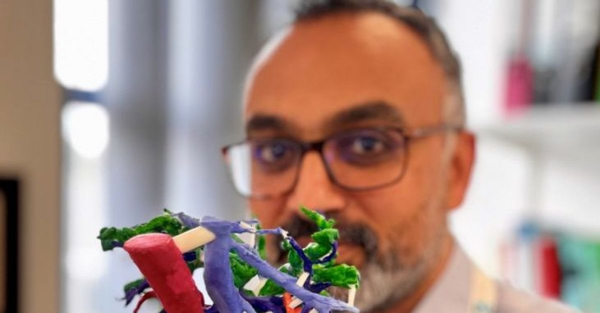 Хирурзите разработват 3D отпечатани модели на черен дроб, за да планират сложна операция на рак