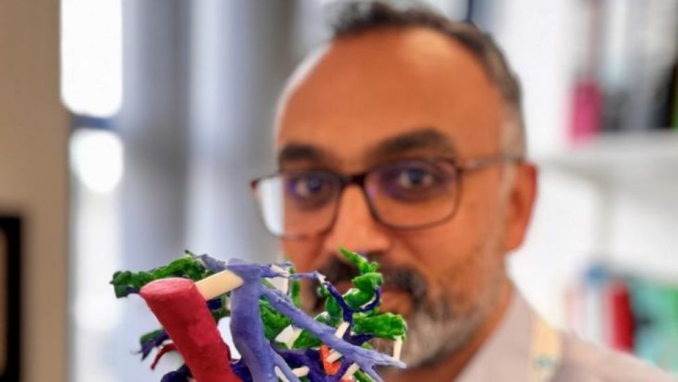 Surgeons Develop 3D-Printed Liver Models To Plan Complex Cancer Surgery