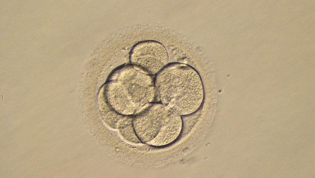 Couple sue fertility clinic over loss of embryos