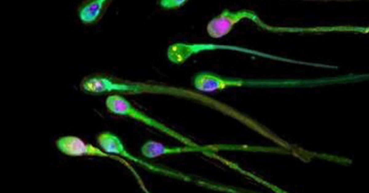 Ново изследване открива, че бавните сперматозоиди могат да бъдат стимулирани от ултразвукови вълни