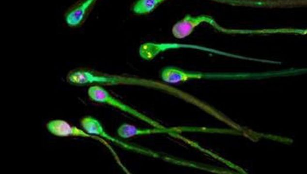 New Research Discovers Sluggish Sperm Can Be Boosted By Ultrasound Waves