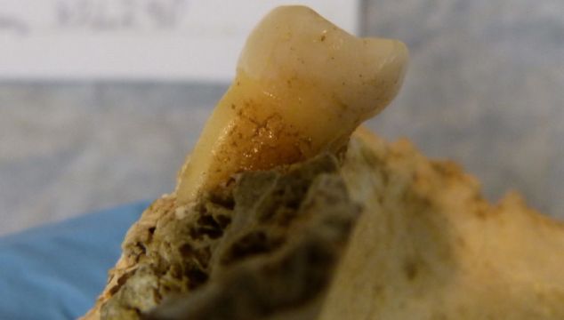 Evidence Of Tooth Decay-Causing Bacteria Found In 4,000-Year-Old Human Molars