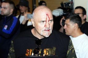 Tyson Fury’s Father John Suffers Cut To Head As Oleksandr Usyk Fight Week Begins