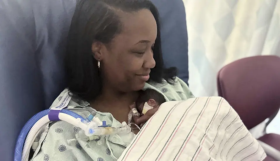 ‘Micropreemie’ Baby Who Weighed 1Lb And 1Oz At Birth Goes Home From Hospital