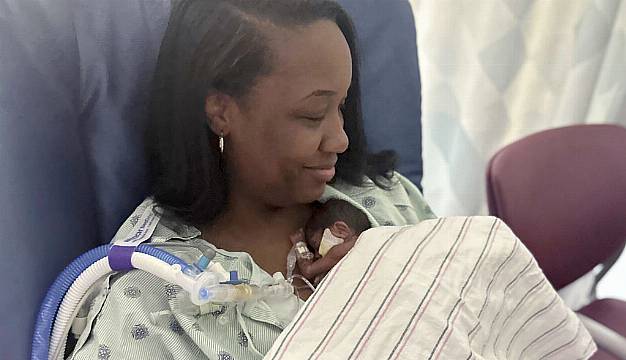 ‘Micropreemie’ Baby Who Weighed 1Lb And 1Oz At Birth Goes Home From Hospital