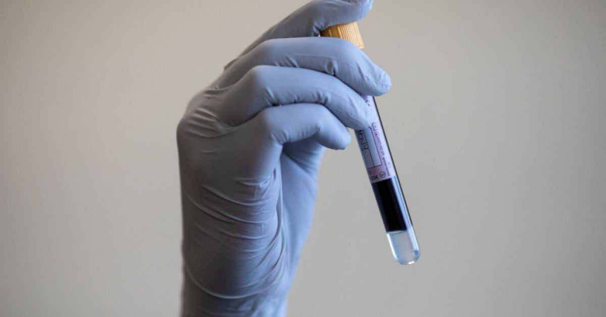 Нов тип кръвен тест може да предскаже дали ракът на