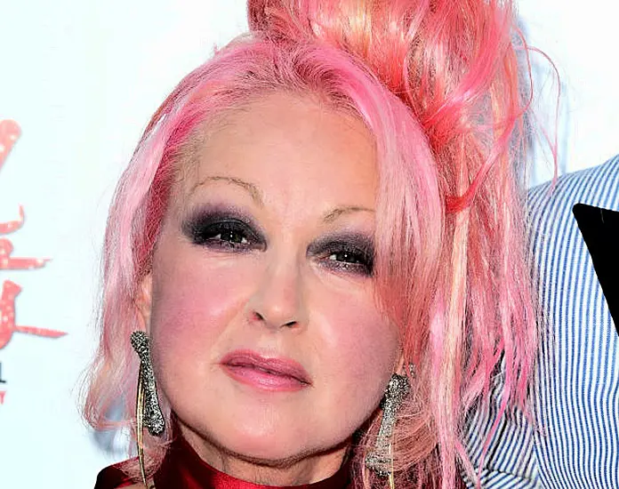 Cher Celebrates ‘Genius Singer’ Cyndi Lauper At Handprint Ceremony