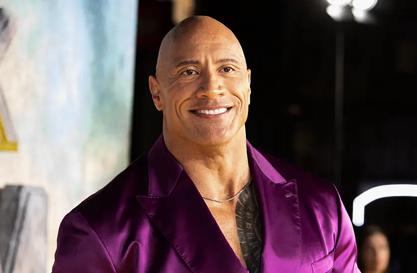 Dwayne Johnson Suffers Injury On Set Of The Smashing Machine