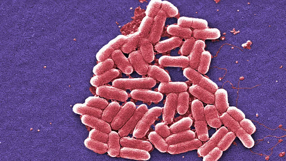 One Person Dies Linked To E.coli Outbreak ‘Spread By Lettuce’