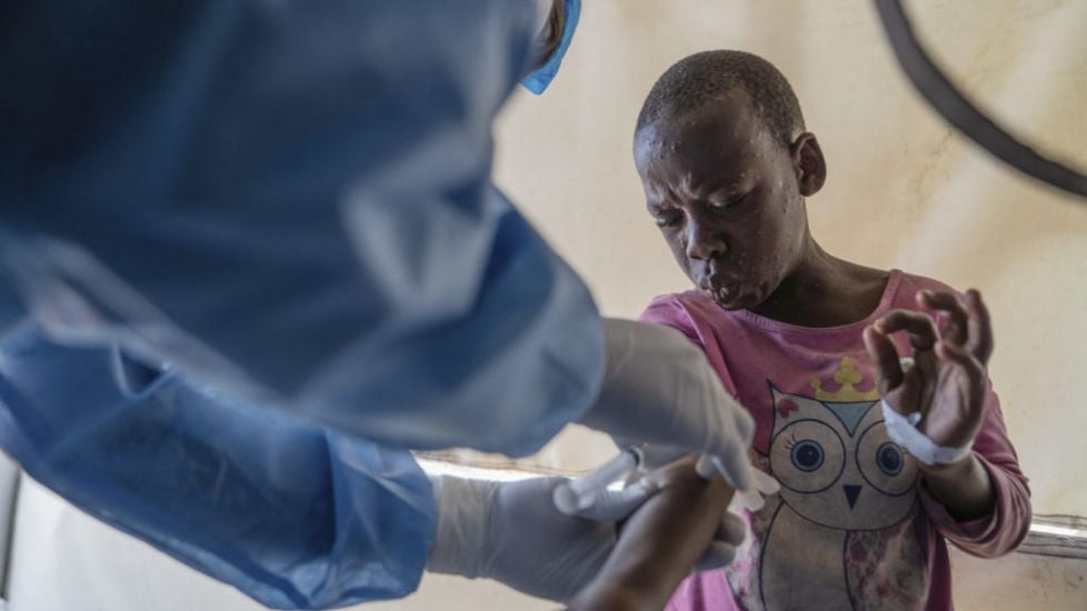 Who Grants First Mpox Vaccine Approval To Ramp Up Response To Disease In Africa