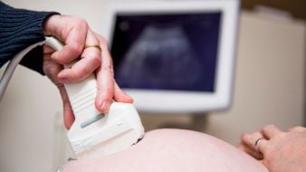 Couple Settle Case Against Hse Over Pregnancy Anomaly Scan