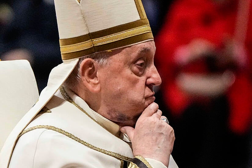 Pope Francis Spotted With A Bruise As He Appoints New Cardinals