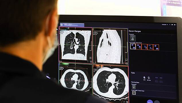 Early Cancer Diagnosis In England Reaches Highest Level