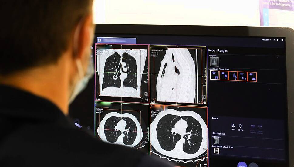 Early Cancer Diagnosis In England Reaches Highest Level