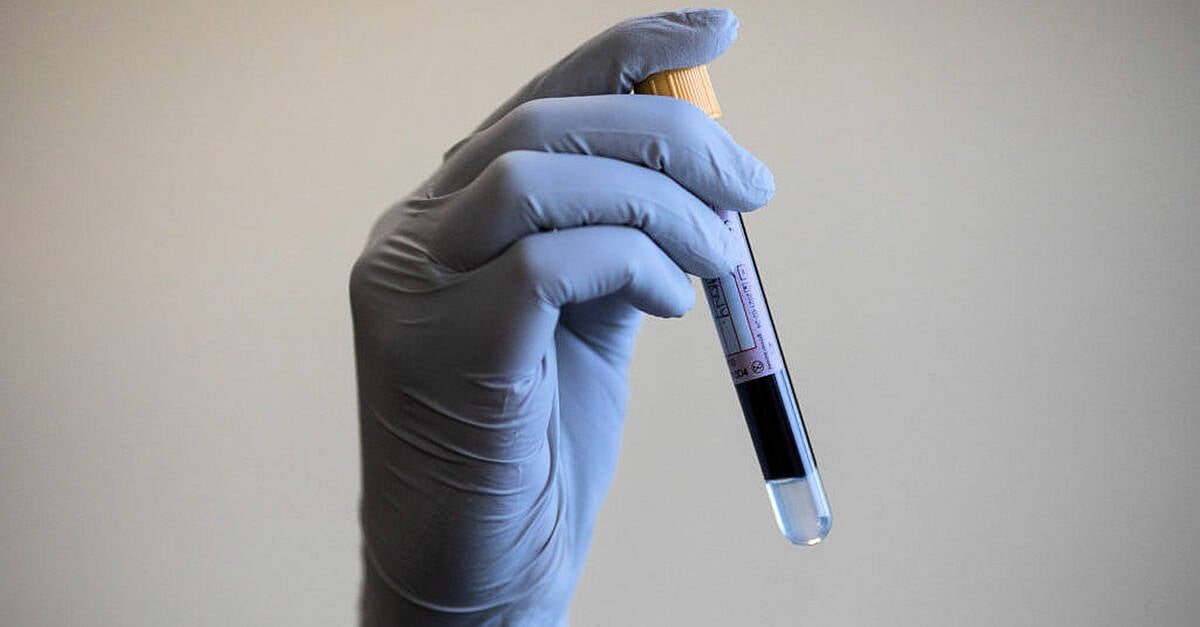 Blood test shows promising results in detecting cancer early, study says