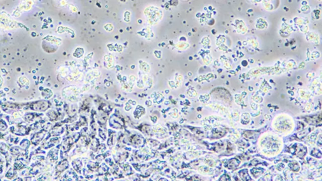 Researchers To Create Cancer Vaccine To Stop Disease Developing