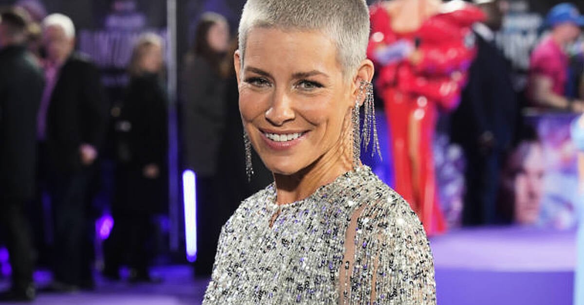 Marvel’s Evangeline Lilly says she had ‘hole punctured into face’ after fainting