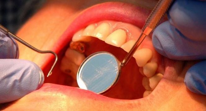 Dentistry Faces 'Resourcing Crisis' As Skilled Staff Move To Testing And Tracing