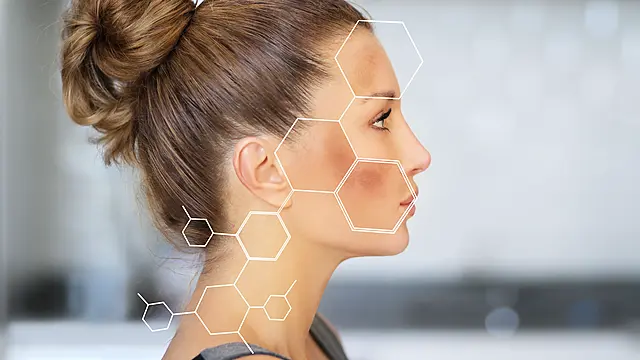 Hyperpigmentation: How To Tackle Those Tricky Dark Patches On Your Skin