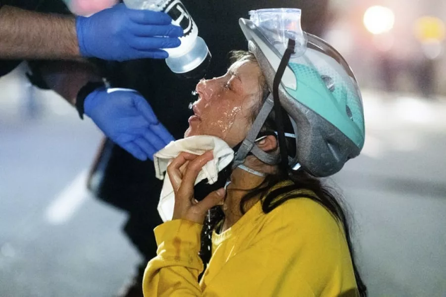 A medic treats Black Lives Matter protester Lacey Wambalaba after exposure to chemical irritants deployed by federal officers (Noah Berger/AP)