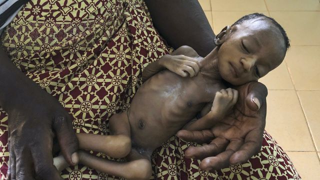Coronavirus-Linked Hunger Tied To 10,000 Child Deaths Each Month