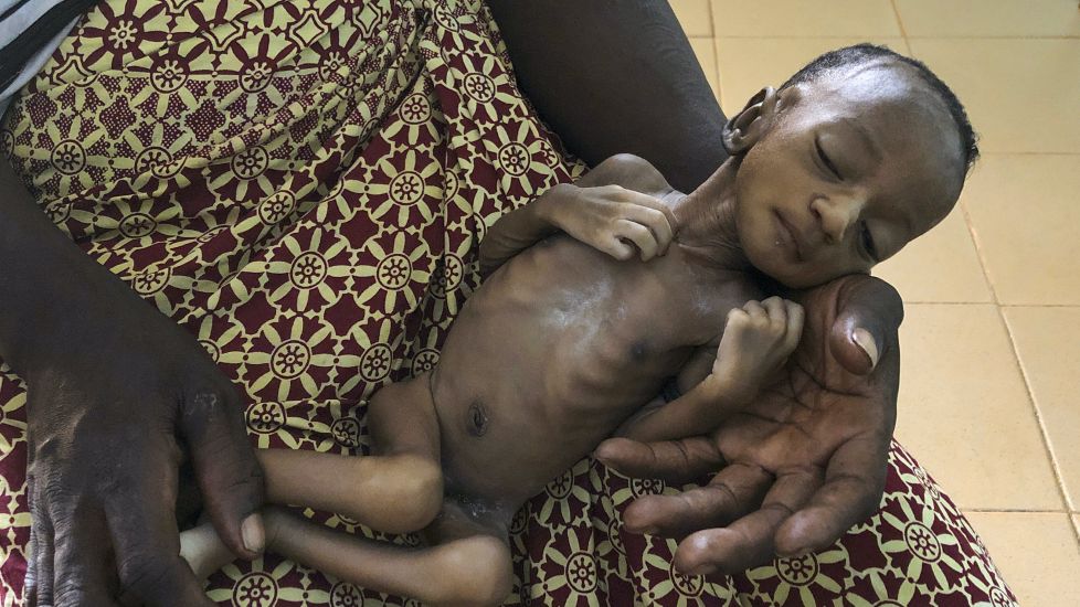 Coronavirus-Linked Hunger Tied To 10,000 Child Deaths Each Month