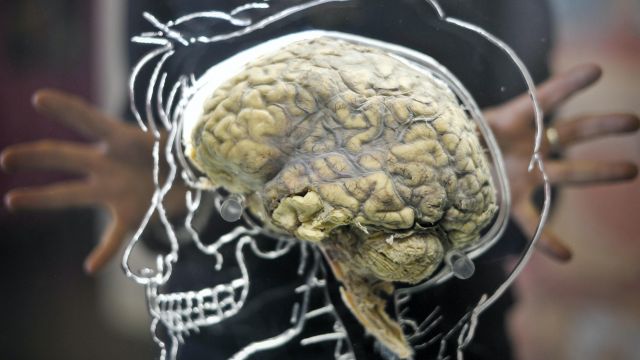 Scientists Identify Genes That Drive Aggressive Brain Cancer