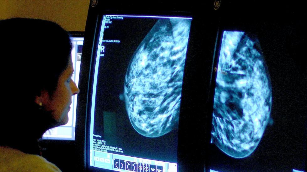 Breast Screening For Women In Their 40S ‘Could Save Up To 400 Lives A Year’