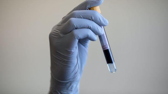 Blood Test ‘Could Identify Covid-19 Patients At Greatest Risk Of Severe Illness’