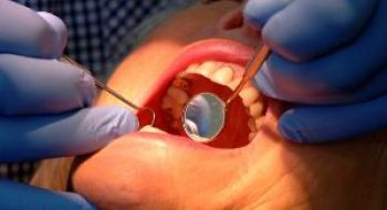 Over 100,000 Children Denied School Dental Screening Appointments Last Year