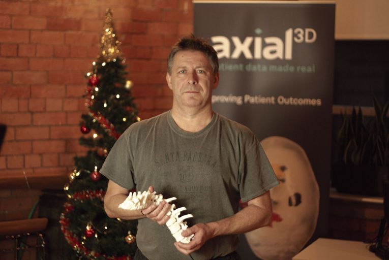 Roger Johnston, chief executive of Axial3D: “We’re also looking to double the number of staff at our company over the next two years. Our challenge is scalability.”