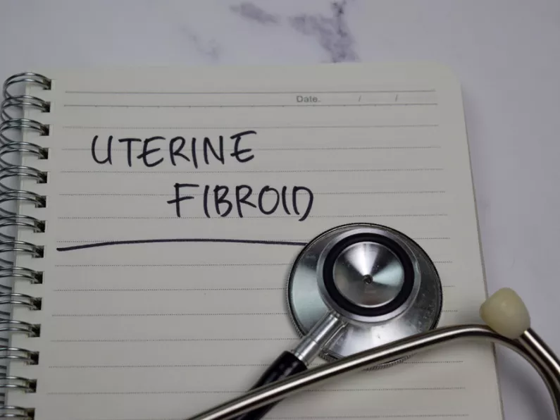 Women who sit for 6 hours a day twice as likely to develop uterine fibroids