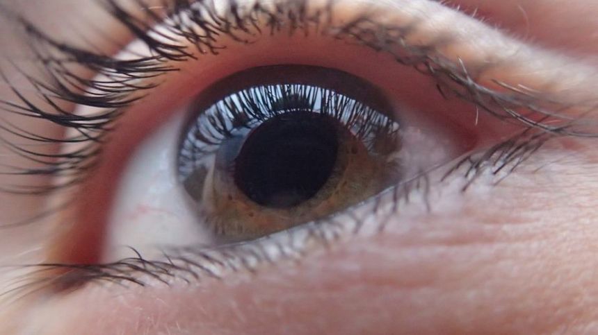 Minister urged to speed up eye care for Galway patients