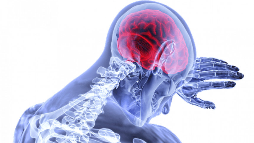 Clarinbridge information evening to discuss living with brain injuries