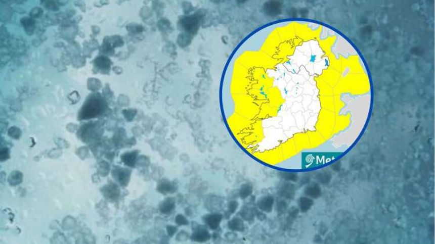 Hail and wind warnings for Galway now in place