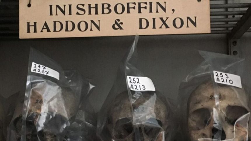 Set of historic skulls stolen from Inishbofin to be returned this weekend