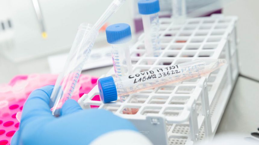 14% increase in PCR tests at Galway testing centres